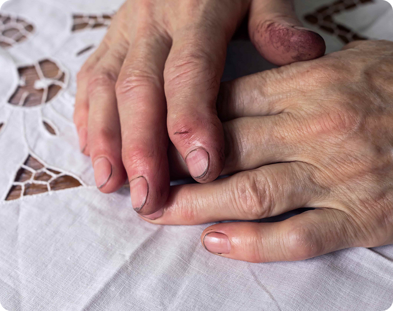 Essential Tremor surgery consultation, where a doctor and patient review brain scan results together.