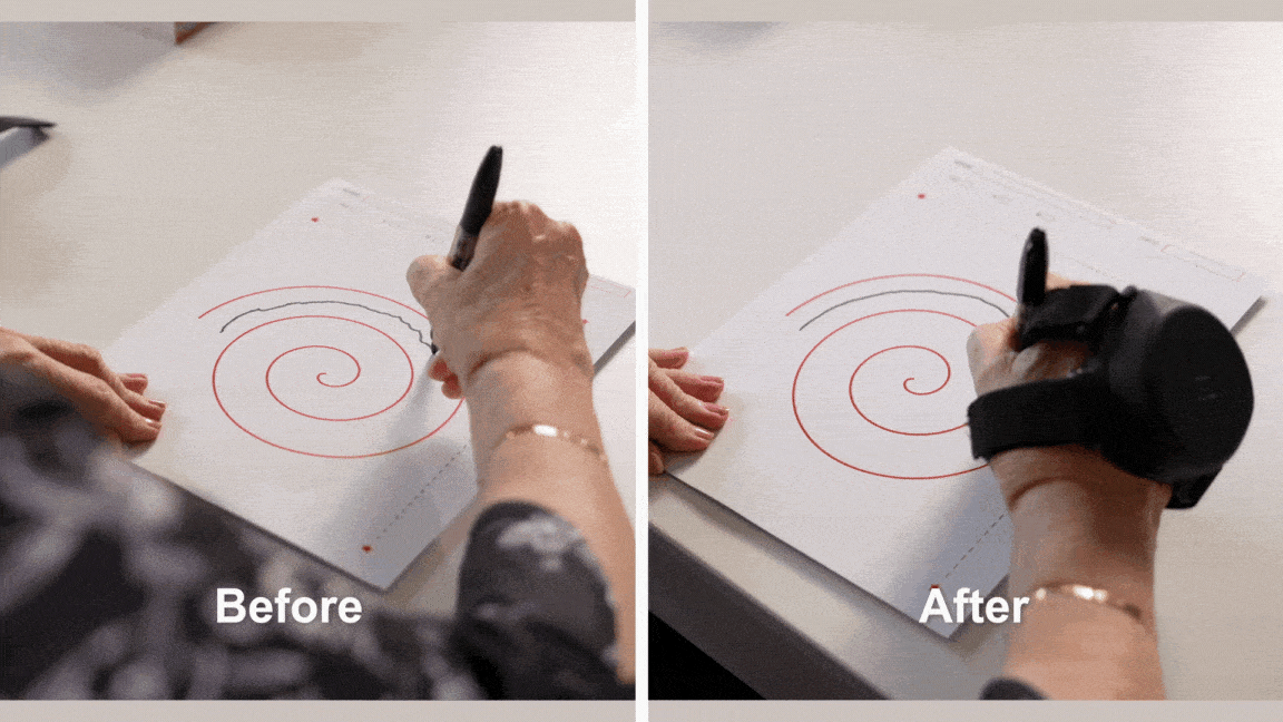 Before and after using Steadi-3: a person draws a spiral with steady control.