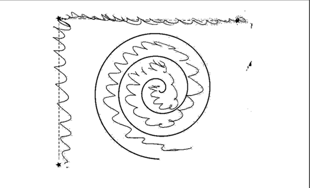 Archimedes spiral drawn without the device: moderate to severe tremor